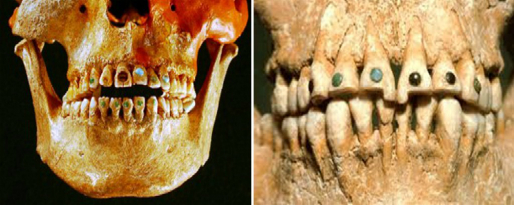 Mayan-civilization-gemstone-teeth-gold-grillz